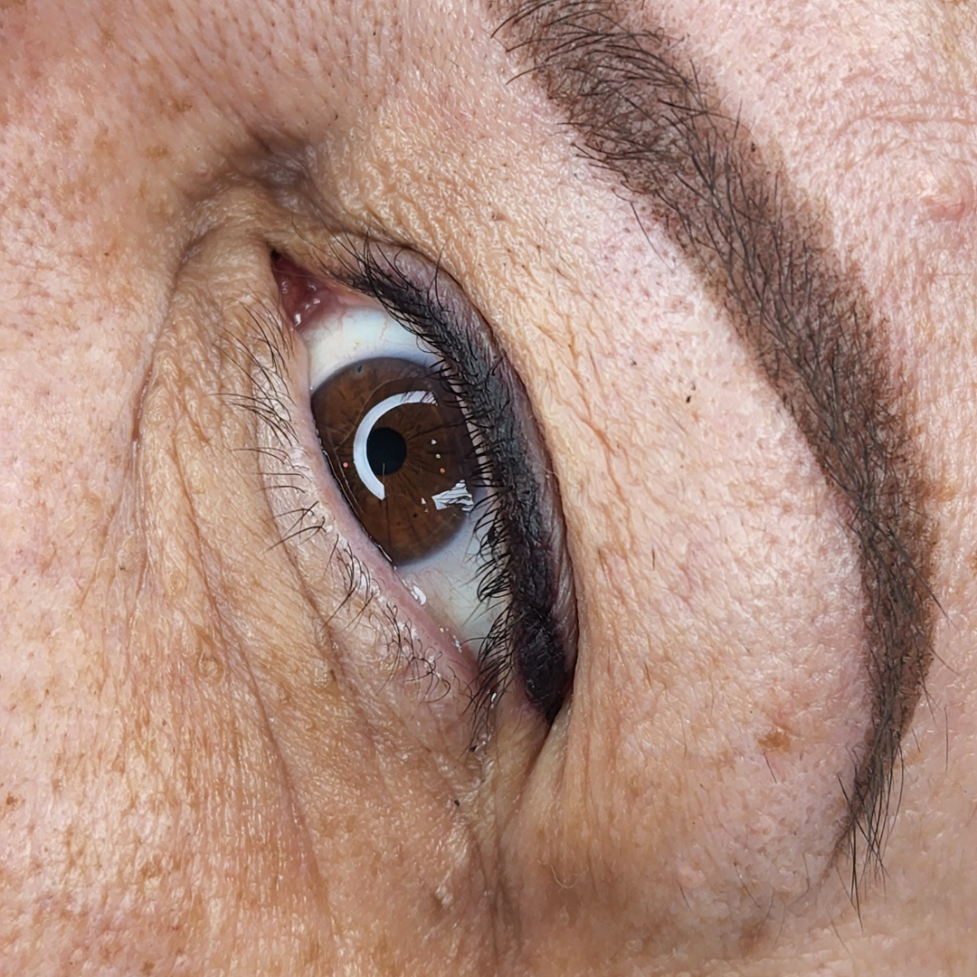 Eye Brow Lasing - Services - Happy Client